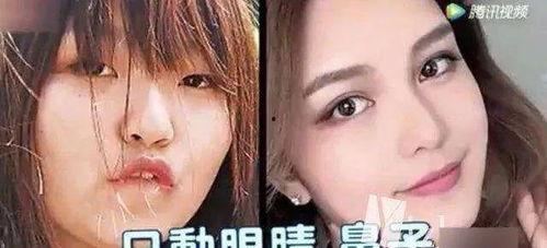 整容最好看的网红